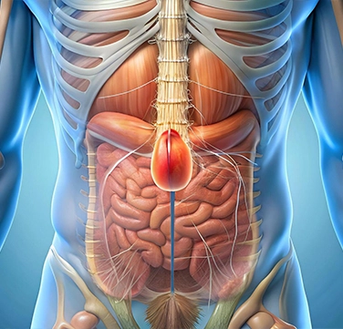 Incisional hernia
